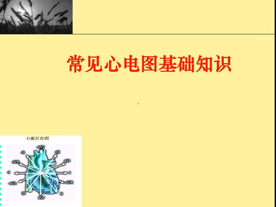 常见心电图基础知识.ppt_第1页