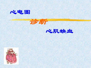 心电图诊断心肌缺血.ppt
