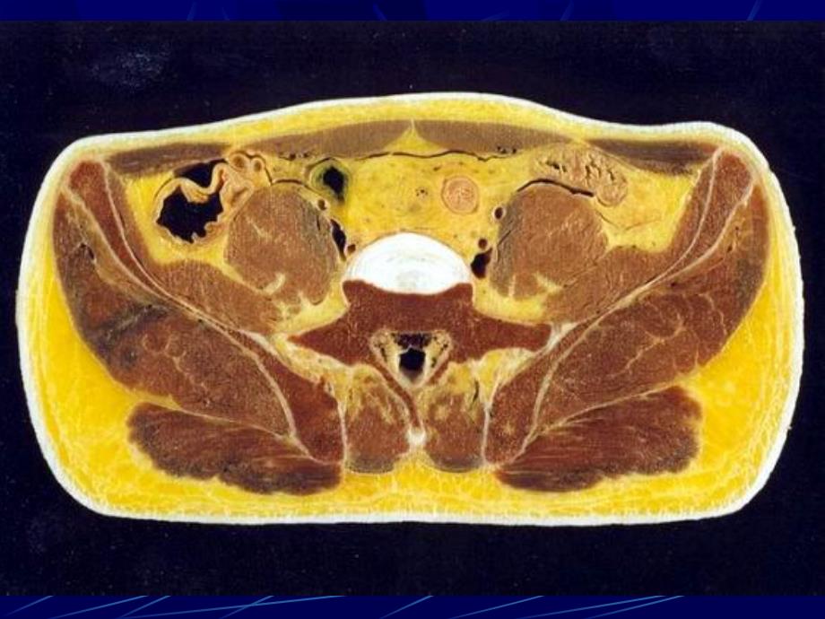 男性盆部和会阴断层解剖.ppt_第2页