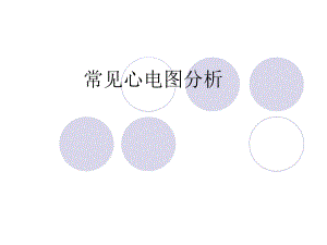 常见心电图分析.ppt