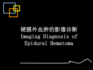 硬膜外血肿的CT诊断ppt.ppt