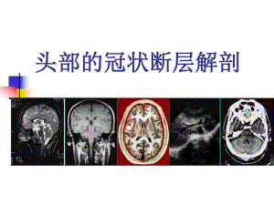 头部的冠状断层解剖应用.ppt