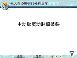 主动脉窦瘤破裂.ppt