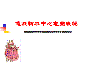 急性脑卒中心电图表现.ppt