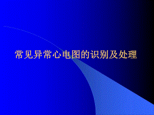 常见异常心电图识别及处理知识.ppt