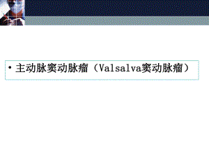主动脉窦动脉瘤.ppt