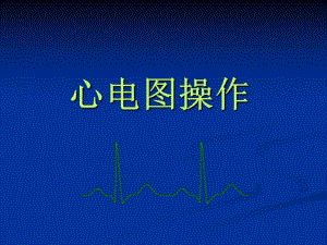 心电图操作规范.ppt