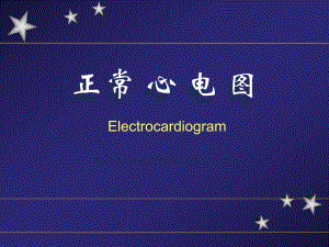 心电图幻灯片内一科[优质文档].ppt