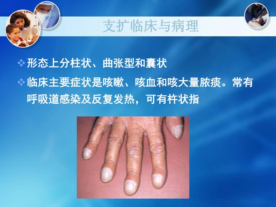 支气管扩张症影像表现.ppt_第3页