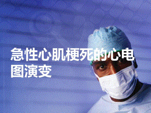 医学资料急性心肌梗死的心电图演变过程.ppt