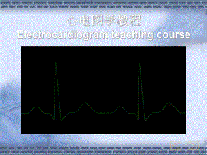 心电图中.ppt