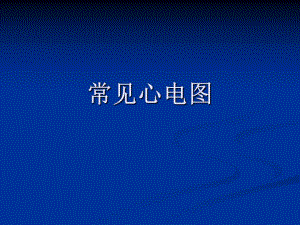 [整理版]心电图,三基培训.ppt