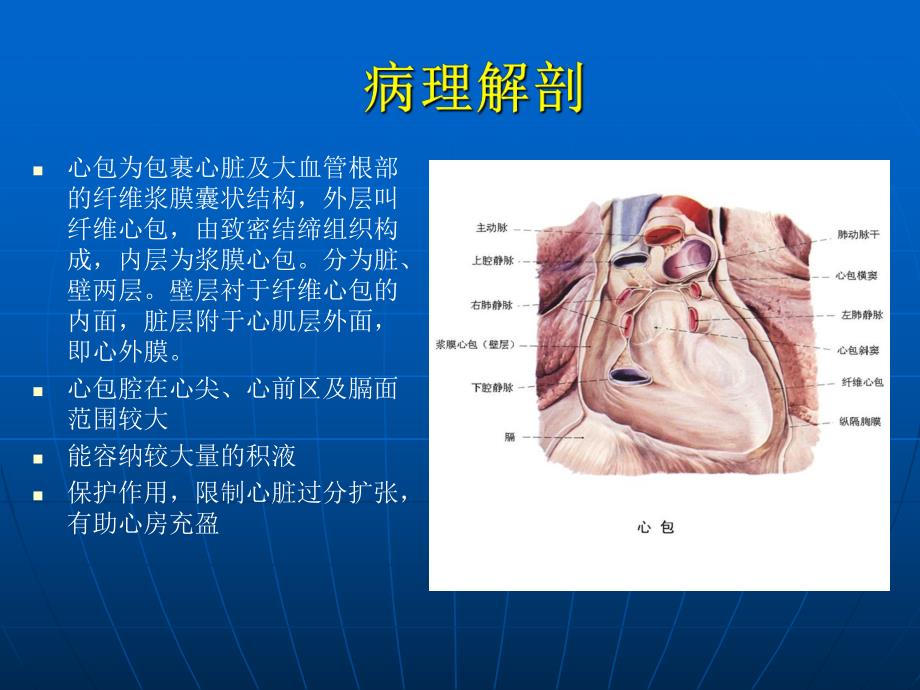 【精品】心包积液.ppt_第2页
