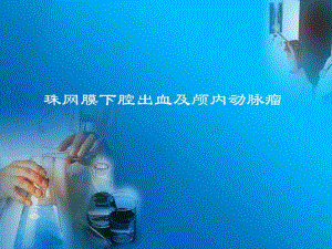 珠网膜下腔出血与动脉瘤.ppt