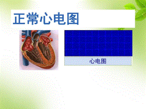 正常心电图.ppt