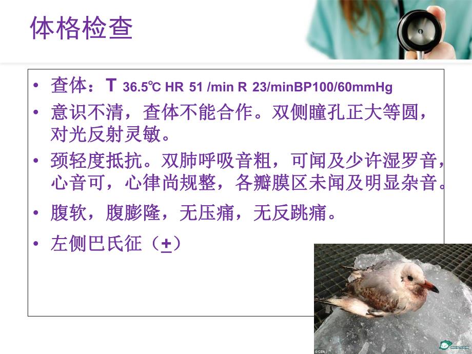 主动脉夹层业务学习.ppt_第3页