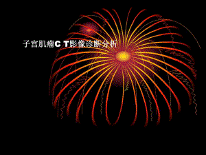 子宫肌瘤CT影像分析.ppt