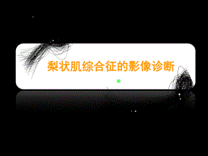 梨状肌综合征的影像诊断.ppt