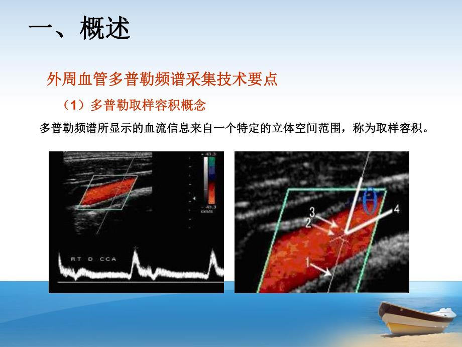 CEA的术前及术中超声评价.ppt_第3页