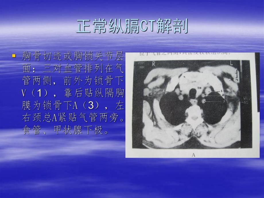 胸部正常横断面解剖.ppt_第3页