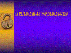 经桡动脉径路冠状动脉造影.ppt