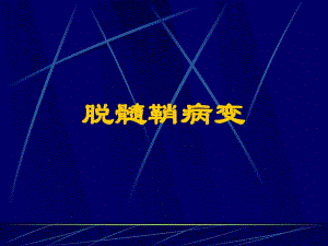 脱髓鞘病变修改.ppt