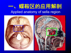 蝶鞍区应用解剖.ppt