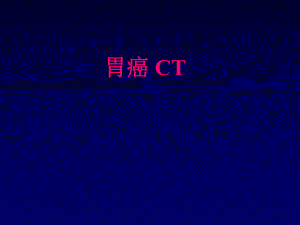 胃癌的CT诊断基本要素.ppt