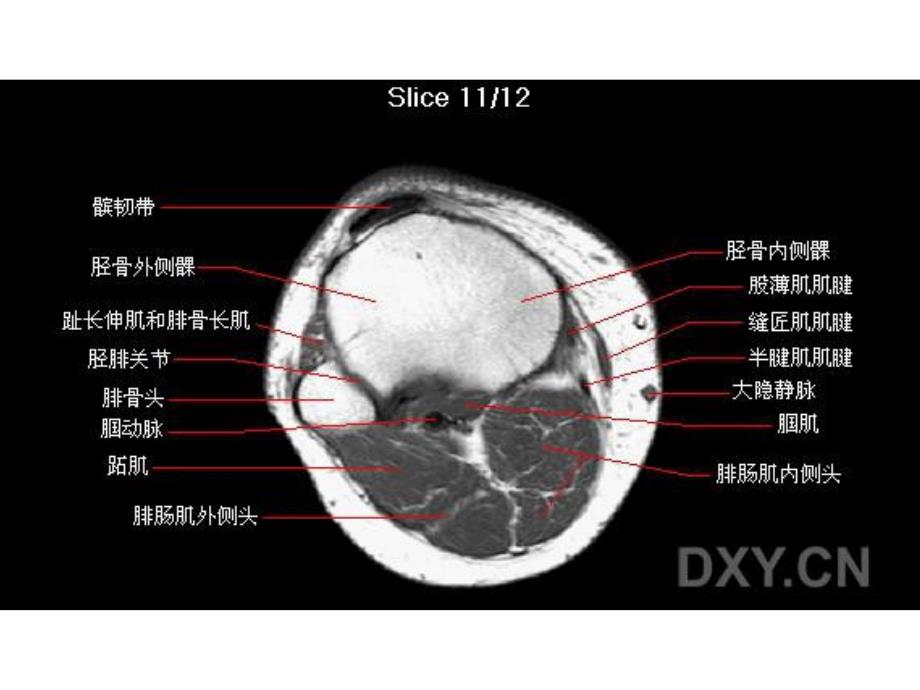 膝部MRI解剖.ppt_第2页