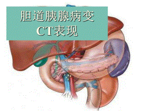 胆胰腺CT.ppt