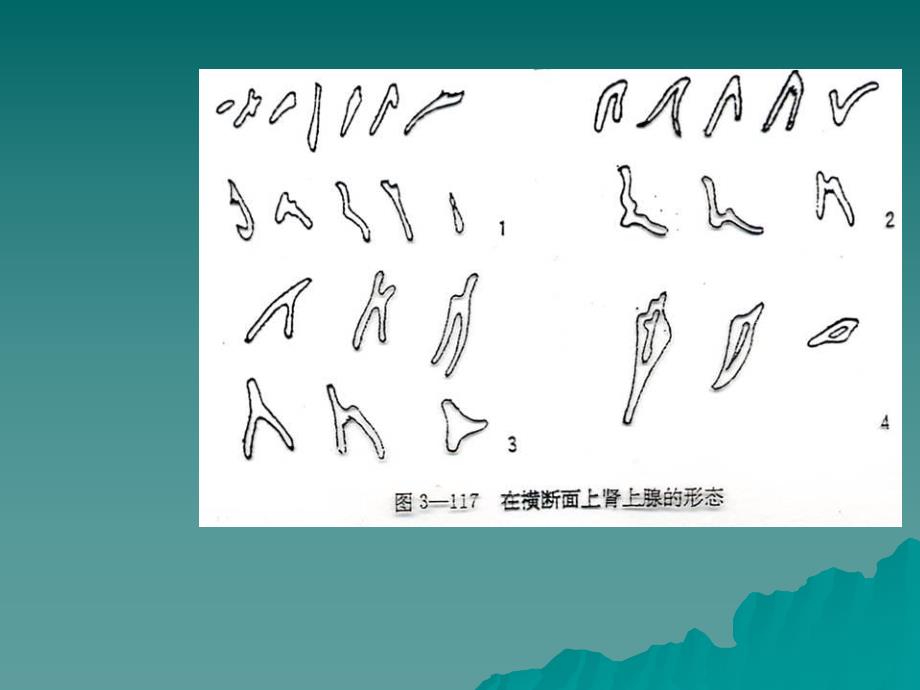 腹部断层.ppt_第3页