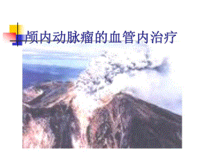 颅内动脉瘤的血管内治疗.ppt