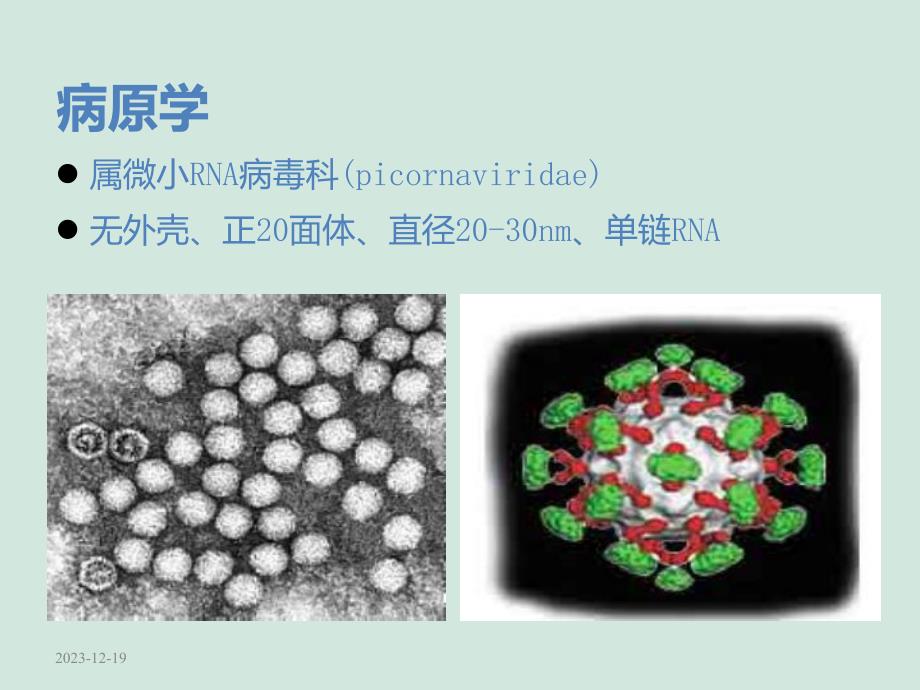 手足口病[最新].ppt_第3页