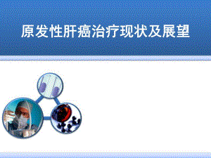 原发性肝癌治疗现状及展望.ppt