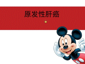原发性肝癌2.ppt