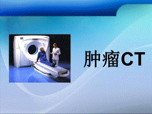 常见肿瘤CT表现.ppt