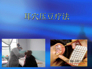 耳穴压豆疗法.ppt