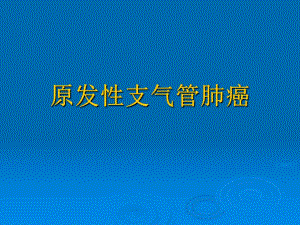 原发性支气管肺癌.ppt