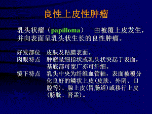 常见肿瘤.ppt