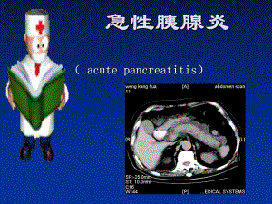 21急性胰腺炎.ppt