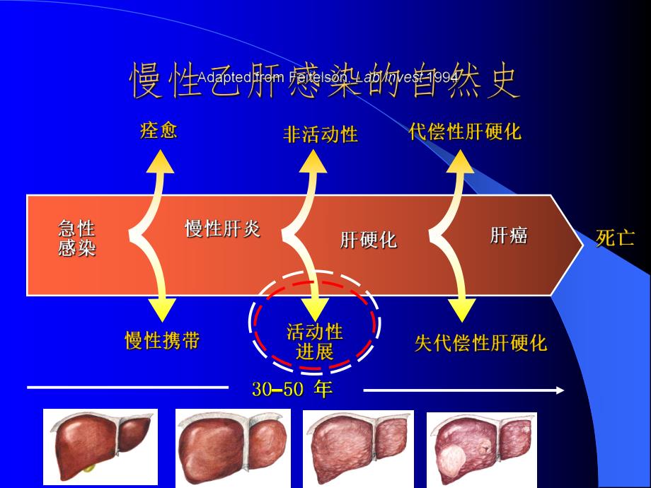 乙肝病人应怎样选择治疗方法.ppt_第2页