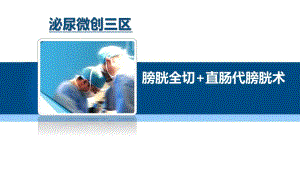 膀胱全切 直肠代膀胱术.ppt