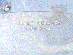 腹腔镜下直肠癌切除.ppt