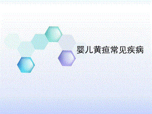 婴儿高胆红素血症.ppt