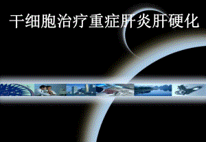 干细胞治疗重症肝炎肝硬化.ppt