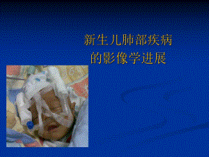 Xray在新生儿的临床应用.ppt