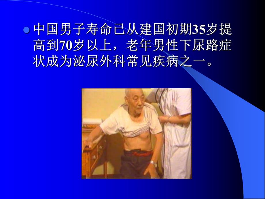 老男性下尿路症状的评估.ppt.ppt_第2页