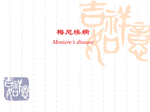梅尼埃病刘芳.ppt