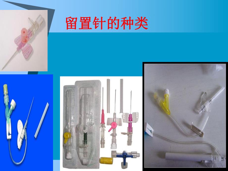 小儿留置针.ppt.ppt_第3页