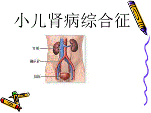 小儿肾病综合征.ppt